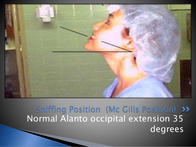 airway-assessment-46-638